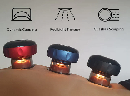 Smart Cupping Device